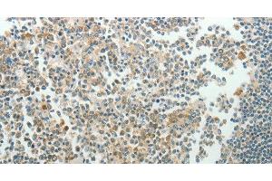 Immunohistochemistry of paraffin-embedded Human tonsil using NDRG3 Polyclonal Antibody at dilution of 1:70 (NDRG3 抗体)