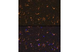 Immunofluorescence (IF) image for anti-Glial Fibrillary Acidic Protein (GFAP) (C-Term) antibody (ABIN3020751)