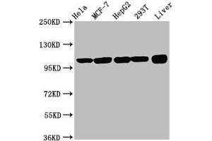 Western Blot Positive WB detected in: Hela whole cell lysate, MCF-7 whole cell lysate, HepG2 whole cell lysate, 293T whole cell lysate, Rat liver tissue All lanes: ACTN4 antibody at 3. (alpha Actinin 4 抗体  (AA 160-440))
