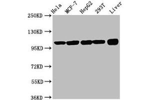 Western Blot Positive WB detected in: Hela whole cell lysate, MCF-7 whole cell lysate, HepG2 whole cell lysate, 293T whole cell lysate, Rat liver tissue All lanes: ACTN4 antibody at 3.