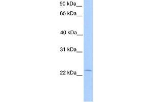 WB Suggested Anti-C5orf39 Antibody Titration: 0. (Chromosome 5 Open Reading Frame 39 (C5orf39) (N-Term) 抗体)
