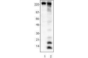 Western Blotting (WB) image for anti-Acetylated Lysine (acetylated) antibody (ABIN2666081) (Acetylated Lysine 抗体  (acetylated))