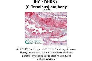Image no. 1 for anti-Dehydrogenase/reductase (SDR Family) Member 7 (DHRS7) (C-Term) antibody (ABIN1733630) (DHRS7 抗体  (C-Term))