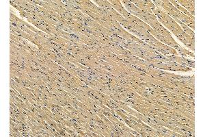 ABIN7095376 and ABIN7099433 at 1/100 staining rat heart tissue by IHC-P.