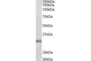 Western Blotting (WB) image for anti-CTD (Carboxy-terminal Domain, RNA Polymerase II, Polypeptide A) Small Phosphatase 1 (CTDSP1) (Internal Region) antibody (ABIN2465010) (CTDSP1 抗体  (Internal Region))