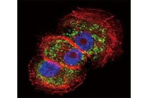 Confocal immunofluorescent analysis of Parkin antibody with NCI-H460 cells followed by Alexa Fluor 488-conjugated goat anti-rabbit lgG (green).