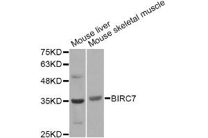 Western blot analysis of extracts of various cell lines, using BIRC7 Antibody.