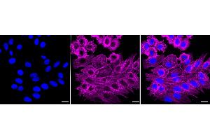 Immunocytochemical staining of HepG2 cells with CCR7 antibody (ABIN7798042), 1:1,000). (Recombinant CCR7 抗体)