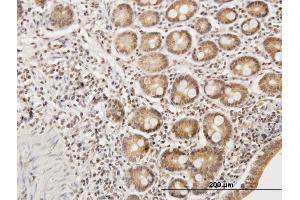 Immunostaining (ISt) image for anti-Ethylmalonic Encephalopathy 1 (ETHE1) (AA 1-254) antibody (ABIN525198)