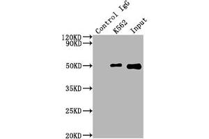 Immunoprecipitating FNTB in K562 whole cell lysate Lane 1: Rabbit control IgG instead of ABIN7127495 in K562 whole cell lysate. (Recombinant FNTB 抗体)