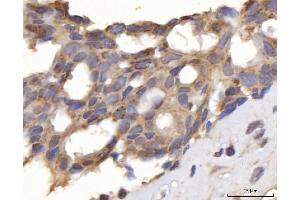 IHC analysis of DLST using anti-DLST antibody (ABIN7599412). (DLST 抗体  (AA 1-453))