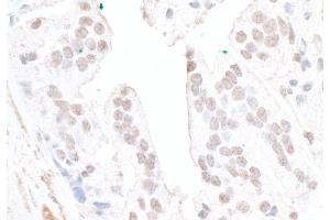 Immunohistochemistry (IHC) image for anti-F-Box and WD Repeat Domain Containing 7 (FBXW7) (AA 50-100) antibody (ABIN7453590)