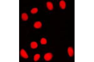 Immunofluorescent analysis of BRF1 staining in NIH3T3 cells. (BRF1 抗体  (Center))