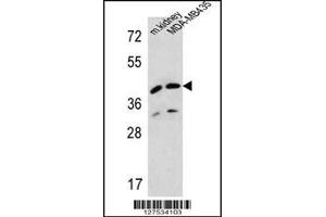 Western blot analysis in MDA-MB435 cell line and mouse kidney tissue lysates (35ug/lane). (L2HGDH 抗体  (AA 132-159))