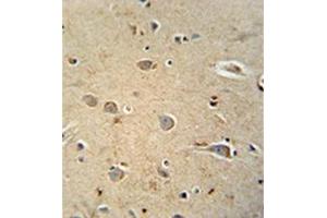 Formalin fixed and paraffin embedded human brain tissue reacted with PQLC1 Antibody  followed by peroxidase conjugation of the secondary antibody and DAB staining. (PQLC1 抗体  (Middle Region))
