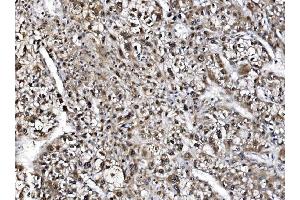 IHC analysis of NOLA1/GAR1 using anti-NOLA1/GAR1 antibody (ABIN7602076).