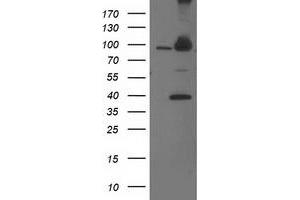 Western Blotting (WB) image for anti-Proteasome (Prosome, Macropain) 26S Subunit, Non-ATPase, 2 (PSMD2) antibody (ABIN1500482) (PSMD2 抗体)