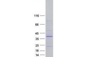 Western Blotting (WB) image for Protein Tyrosine Phosphatase, Non-Receptor Type 20B (PTPN20B) (Transcript Variant 8) protein (Myc-DYKDDDDK Tag) (ABIN2730114)