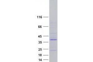 Validation with Western Blot (PTPN20 Protein (Transcript Variant 8) (Myc-DYKDDDDK Tag))