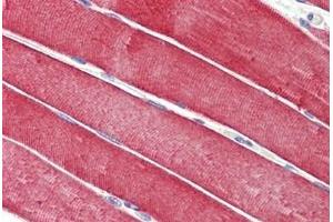 Human Skeletal Muscle: Formalin-Fixed, Paraffin-Embedded (FFPE) (DNAJC5 抗体  (AA 177-191))