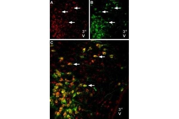 Melatonin Receptor 1B 抗体  (3rd Intracellular Loop)