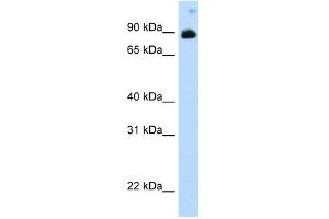 WB Suggested Anti-STAT6 Antibody Titration:  0. (STAT6 抗体  (C-Term))
