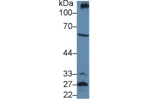 Detection of PODXL in Mouse Kidney lysate using Polyclonal Antibody to Podocalyxin (PODXL) (PODXL 抗体  (AA 171-404))