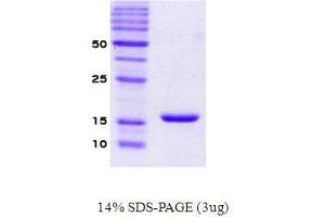 Figure annotation denotes ug of protein loaded and % gel used. (SNCA 蛋白)