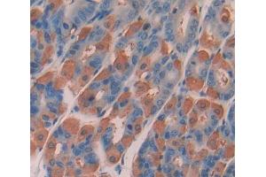 Used in DAB staining on fromalin fixed paraffin- embedded stomach tissue (DPP3 抗体  (AA 2-263))