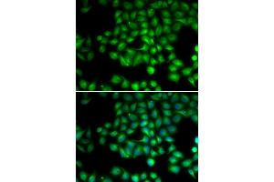 Immunofluorescence analysis of HeLa cells using TRPM2 antibody (ABIN5973615).