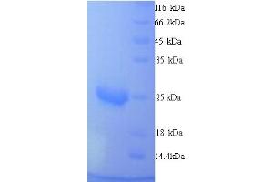 Mucin 2, Oligomeric Mucus/gel-Forming (MUC2) (AA 36-240) protein (His tag)