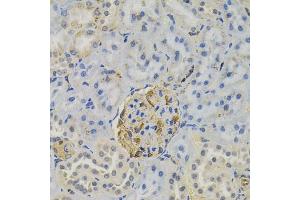 Immunohistochemistry of paraffin-embedded rat kidney using FLT3 antibody (ABIN6131275, ABIN6140693, ABIN6140696 and ABIN6223885) (40x lens). (FLT3 抗体)