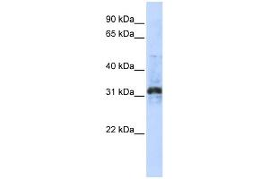 WB Suggested Anti-ZNF705D Antibody Titration:  0. (ZNF705D 抗体  (Middle Region))