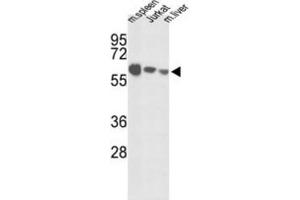 Western Blotting (WB) image for anti-Insulin-Like Growth Factor Binding Protein, Acid Labile Subunit (IGFALS) antibody (ABIN3003239)