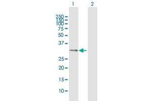 Western Blot analysis of IL1B expression in transfected 293T cell line by IL1B MaxPab polyclonal antibody. (IL-1 beta 抗体  (AA 1-269))