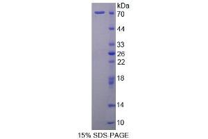 SDS-PAGE analysis of Rat STAM2 Protein.