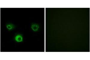 Immunofluorescence analysis of HuvEc cells, using CCR4 Antibody. (CCR4 抗体  (AA 211-260))