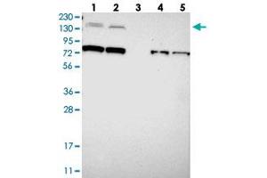 Western blot analysis of Lane 1: RT-4, Lane 2: U-251 MG, Lane 3: Human Plasma, Lane 4: Liver, Lane 5: Tonsil with SORCS1 polyclonal antibody  at 1:250-1:500 dilution.
