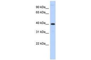 Image no. 1 for anti-Metallophosphoesterase 1 (MPPE1) (AA 107-156) antibody (ABIN6741066)