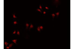 ABIN6266919 staining HeLa  cells by IF/ICC. (ZNF174 抗体  (Internal Region))