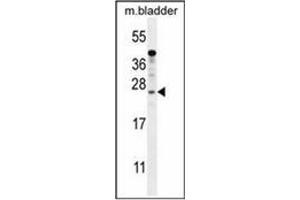 Western blot analysis of KIAA1644 antibody (N-term) in mouse bladder tissue lysates (35ug/lane). (SHISAL1/KIAA1644 抗体  (N-Term))
