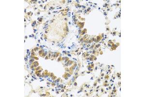 Immunohistochemistry of paraffin-embedded mouse lung using C8orf4 antibody at dilution of 1:100 (40x lens). (C8orf4 抗体)