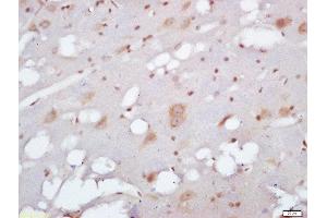 Formalin-fixed and paraffin embedded rat brain labeled with Anti-EXOC2/SEC5 Polyclonal Antibody, Unconjugated  at 1:200 followed by conjugation to the secondary antibody and DAB staining (EXOC2 抗体  (AA 31-130))