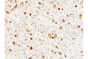 Formalin-fixed, paraffin-embedded human Pituitary stained with FSH beta Mouse Monoclonal Antibody (FSHb/1062).