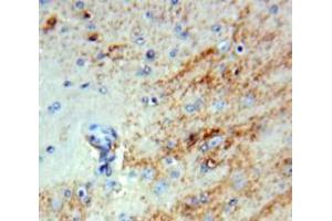 Used in DAB staining on fromalin fixed paraffin-embedded Brain tissue (INHBB 抗体  (AA 50-404))