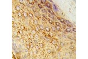 IHC analysis of FFPE human skin tissue stained with LDHA antibody (Lactate Dehydrogenase A 抗体  (AA 154-182))