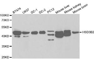 Western blot analysis of extracts of various cell lines, using HSD3B2 antibody. (HSD3B2 抗体)