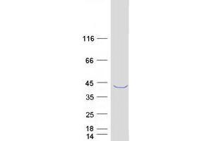Western Blotting (WB) image for Melanoma Antigen Family B, 2 (MAGEB2) protein (Myc-DYKDDDDK Tag) (ABIN2725209)