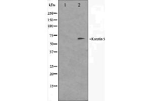 Western blot analysis on HepG2 cell lysate using Keratin 5 Antibody. (Cytokeratin 5 抗体  (C-Term))