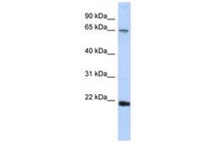 Image no. 1 for anti-DNA repair and recombination protein RAD54B (RAD54B) (C-Term) antibody (ABIN6740311) (RAD54B 抗体  (C-Term))